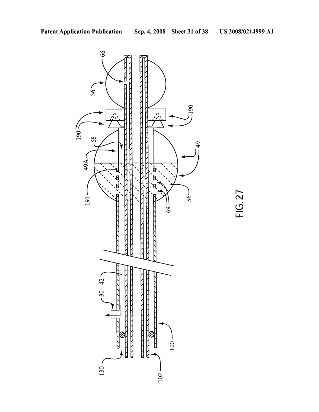 ANGIOPLASTY DEVICE AND METHOD OF MAKING SAME - diagram, schematic, and image 32