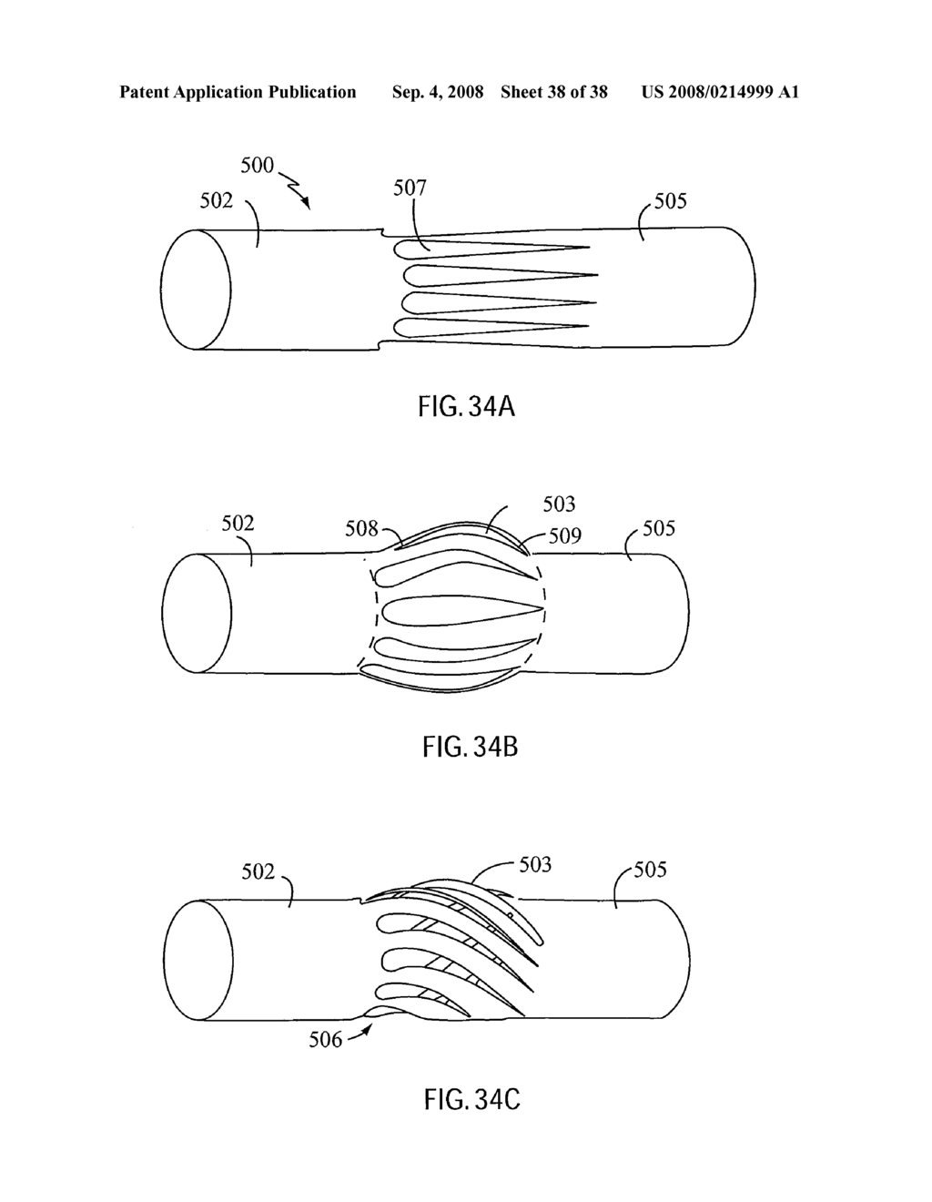 ANGIOPLASTY DEVICE AND METHOD OF MAKING SAME - diagram, schematic, and image 39