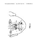 METHODS AND DEVICES FOR NON-INVASIVE CEREBRAL AND SYSTEMIC COOLING diagram and image