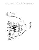 METHODS AND DEVICES FOR NON-INVASIVE CEREBRAL AND SYSTEMIC COOLING diagram and image