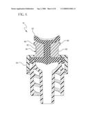 VASCULAR ACCESS DEVICE CHAMBER REPLACEMENT diagram and image