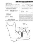 APPARATUS AND METHOD FOR USING AN INTRAOSSEOUS SPACE FOR MOVING FLUID INTO AND OUT OF THE BODY diagram and image