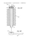 APPARATUS AND METHOD FOR USING AN INTRAOSSEOUS SPACE FOR MOVING FLUID INTO AND OUT OF THE BODY diagram and image