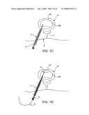 SPINAL DIAGNOSTIC METHODS AND APPARATUS diagram and image