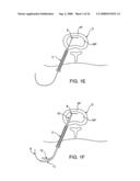 SPINAL DIAGNOSTIC METHODS AND APPARATUS diagram and image