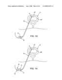 SPINAL DIAGNOSTIC METHODS AND APPARATUS diagram and image