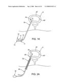 SPINAL DIAGNOSTIC METHODS AND APPARATUS diagram and image