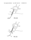 SPINAL DIAGNOSTIC METHODS AND APPARATUS diagram and image