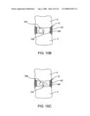 SPINAL DIAGNOSTIC METHODS AND APPARATUS diagram and image