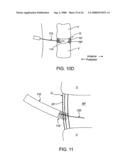 SPINAL DIAGNOSTIC METHODS AND APPARATUS diagram and image