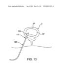 SPINAL DIAGNOSTIC METHODS AND APPARATUS diagram and image