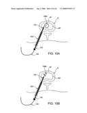 SPINAL DIAGNOSTIC METHODS AND APPARATUS diagram and image