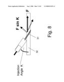 Method and Apparatus for Inhibiting Pain Signals During Vacuum-Assisted Medical Treatments of the Skin diagram and image