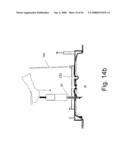 Method and Apparatus for Inhibiting Pain Signals During Vacuum-Assisted Medical Treatments of the Skin diagram and image