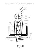 Method and Apparatus for Inhibiting Pain Signals During Vacuum-Assisted Medical Treatments of the Skin diagram and image