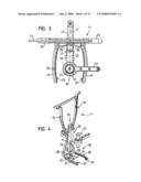 Instrument for Preparing and/or Machining a Femoral Head diagram and image
