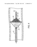 Systems, methods and devices for removing obstructions from a blood vessel diagram and image