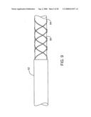 Systems, methods and devices for removing obstructions from a blood vessel diagram and image