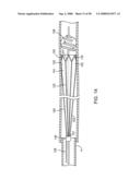 Systems, methods and devices for removing obstructions from a blood vessel diagram and image