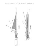 Systems, methods and devices for removing obstructions from a blood vessel diagram and image