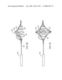 Systems, methods and devices for removing obstructions from a blood vessel diagram and image