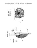 SINGLE DISC INTRALUMINAL FIXATION PATENT FORAMEN OVALE CLOSURE DEVICE diagram and image