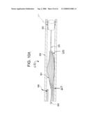 SINGLE DISC INTRALUMINAL FIXATION PATENT FORAMEN OVALE CLOSURE DEVICE diagram and image