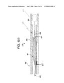 SINGLE DISC INTRALUMINAL FIXATION PATENT FORAMEN OVALE CLOSURE DEVICE diagram and image