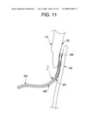 SINGLE DISC INTRALUMINAL FIXATION PATENT FORAMEN OVALE CLOSURE DEVICE diagram and image