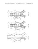 BODILY LUMEN CLOSURE APPARATUS AND METHOD diagram and image