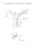 BODILY LUMEN CLOSURE APPARATUS AND METHOD diagram and image