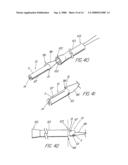 BODILY LUMEN CLOSURE APPARATUS AND METHOD diagram and image