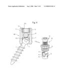 BONE ANCHORING DEVICE diagram and image