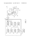 Apparatus and method for temporary treatment of acute heart failure decompensation diagram and image