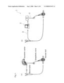 CARDIAC PACING SYSTEM, BLOOD PRESSURE REGULATING SYSTEM, AND CARDIAC DISEASE TREATMENT SYSTEM BY SUBSTITUTING NATIVE BIOLOGICAL REGULATORY FUNCTION diagram and image