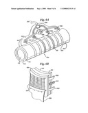 RF Diathermy and Faradic Muscle Stimulation Treatment diagram and image