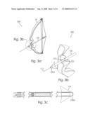 Bow Sighting Device diagram and image