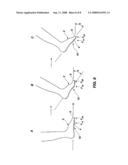 Device for promoting toe-off during gait diagram and image