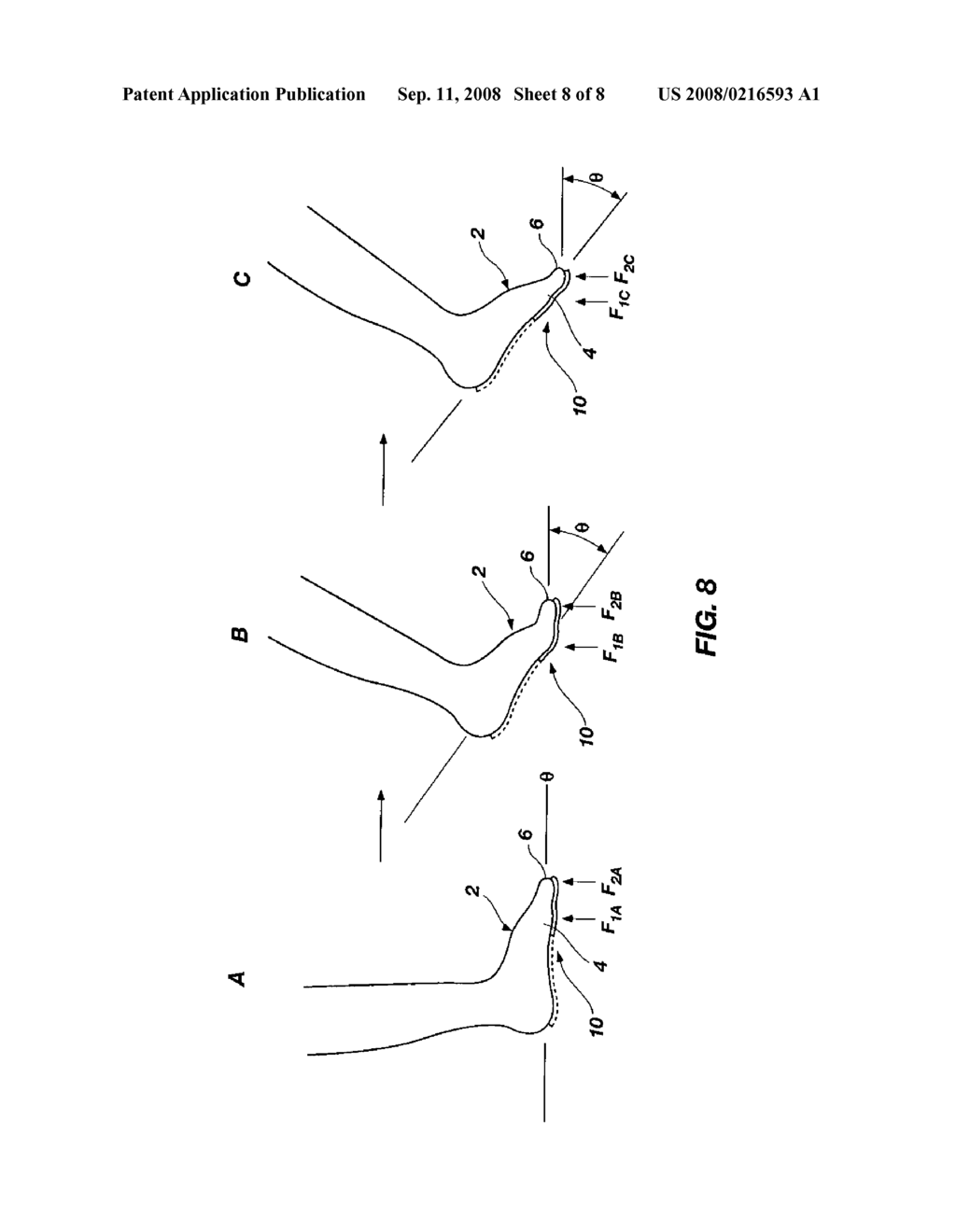 Device for promoting toe-off during gait - diagram, schematic, and image 09