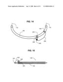 Airway imaging system diagram and image