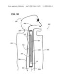 Airway imaging system diagram and image