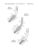 COILED TUBING WELLBORE CLEANOUT diagram and image