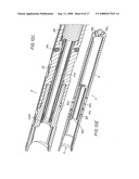 COILED TUBING WELLBORE CLEANOUT diagram and image