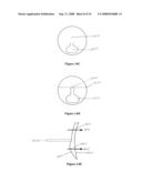 MULTIFOCAL LENS HAVING A PROGRESSIVE OPTICAL POWER REGION AND A DISCONTINUITY diagram and image