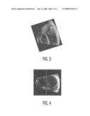 System and Method for Selective Blending of 2D X-Ray Images and 3D Ultrasound Images diagram and image