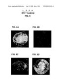 Inhibition of Wet Type Age Related Macular Degeneration (Amd) by Adiponectin or Acrp 30 diagram and image