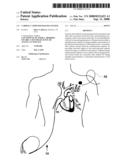 Cardiac Catheter Imaging System diagram and image