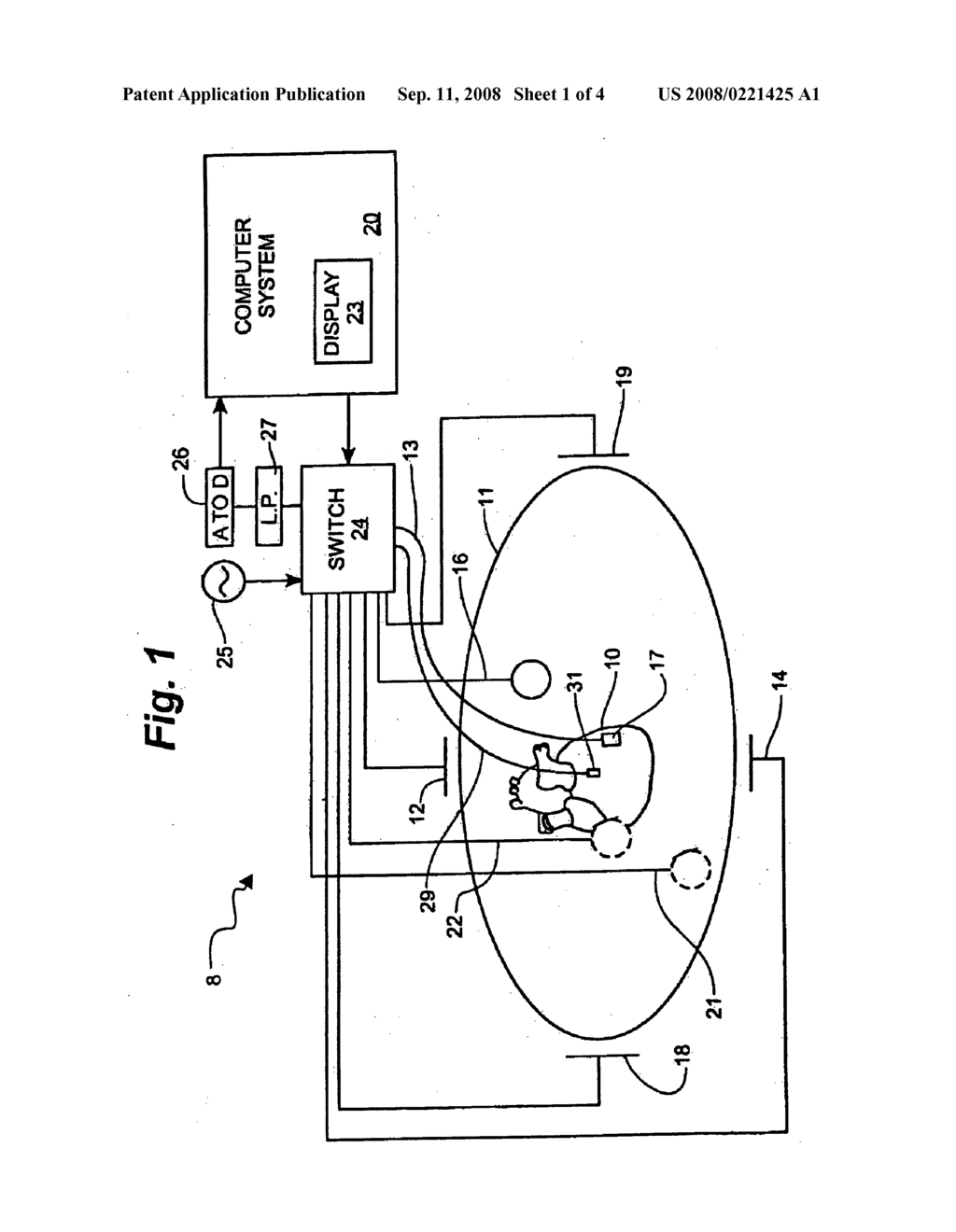 System and method for local deformable registration of a catheter navigation system to image data or a model - diagram, schematic, and image 02