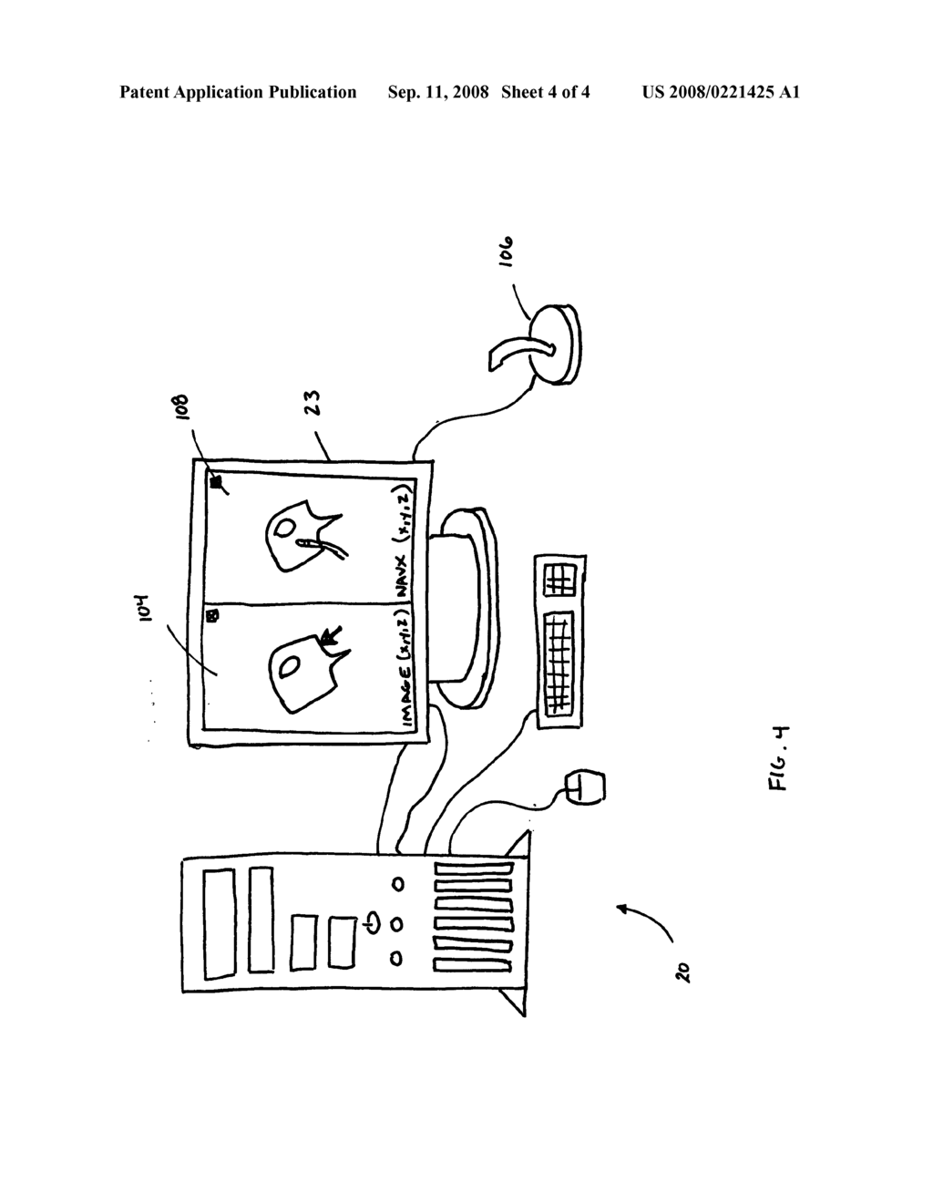 System and method for local deformable registration of a catheter navigation system to image data or a model - diagram, schematic, and image 05