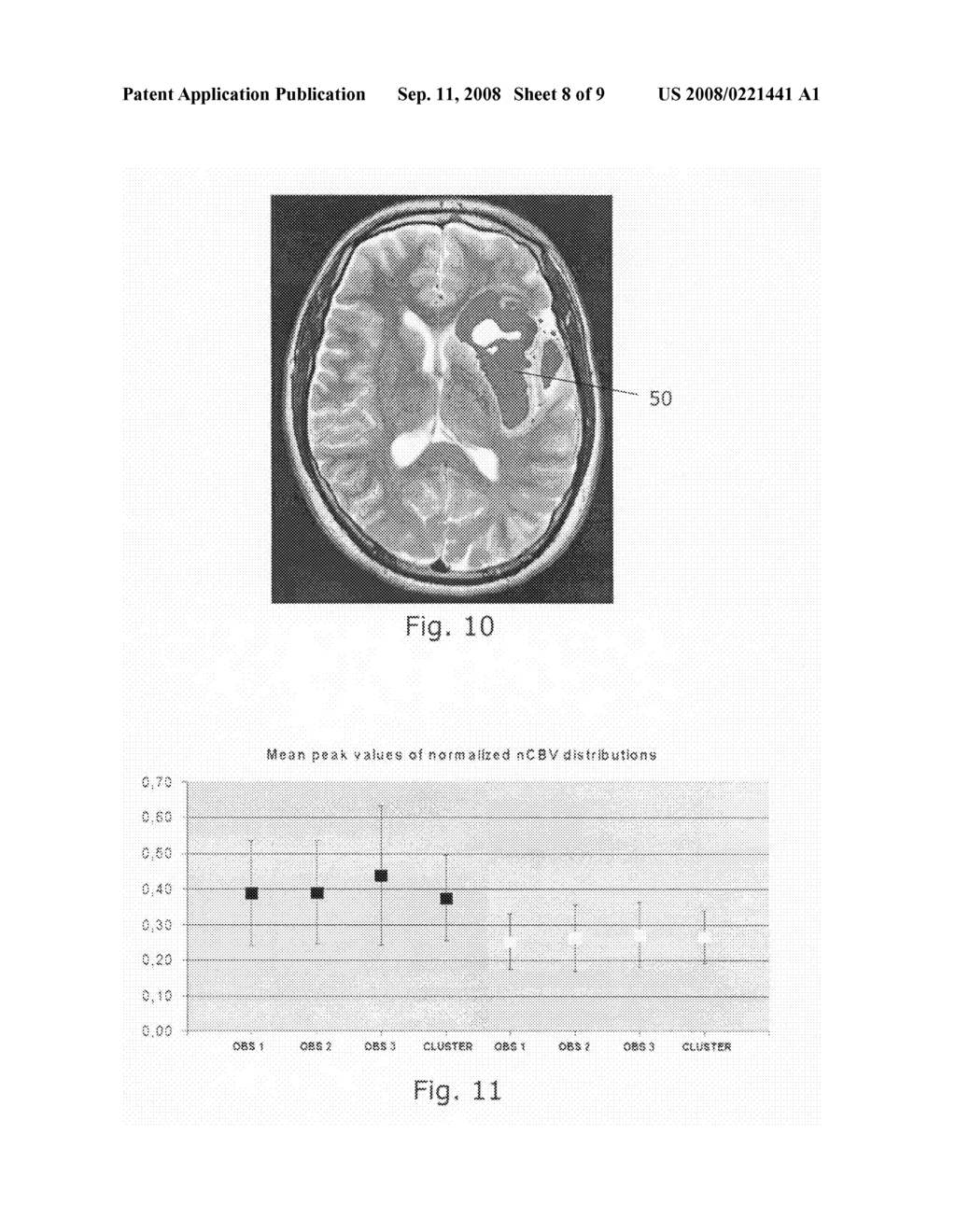 Tumor grading from blood volume maps - diagram, schematic, and image 09